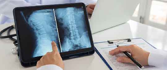 BONE X-RAY