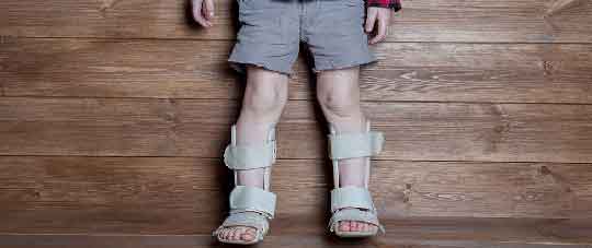 CONGENITAL SKELETAL